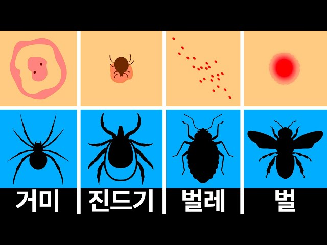 빈대(베드 버그), 벼룩, 모기, 진드기, 좀벌레, 집게벌레, 개미, 거미, 벌, 이 : 무는 벌레 10종 총정리 + 퇴치방법