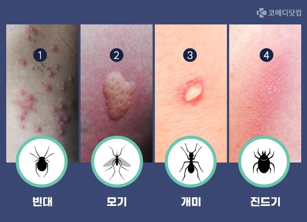 빈대(베드 버그), 벼룩, 모기, 진드기, 좀벌레, 집게벌레, 개미, 거미, 벌, 이 : 무는 벌레 10종 총정리 + 퇴치방법