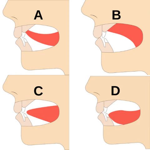 Snoring and Sleep Apnea : Why Men Snore More Than Women 7 Why Men Snore More Than Women: Understanding Snoring and Sleep Apnea